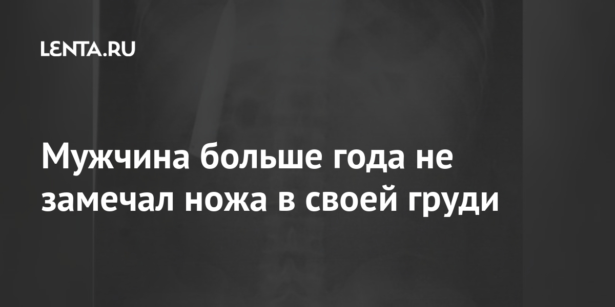 Мужчина больше года не замечал ножа в своей груди Из жизни