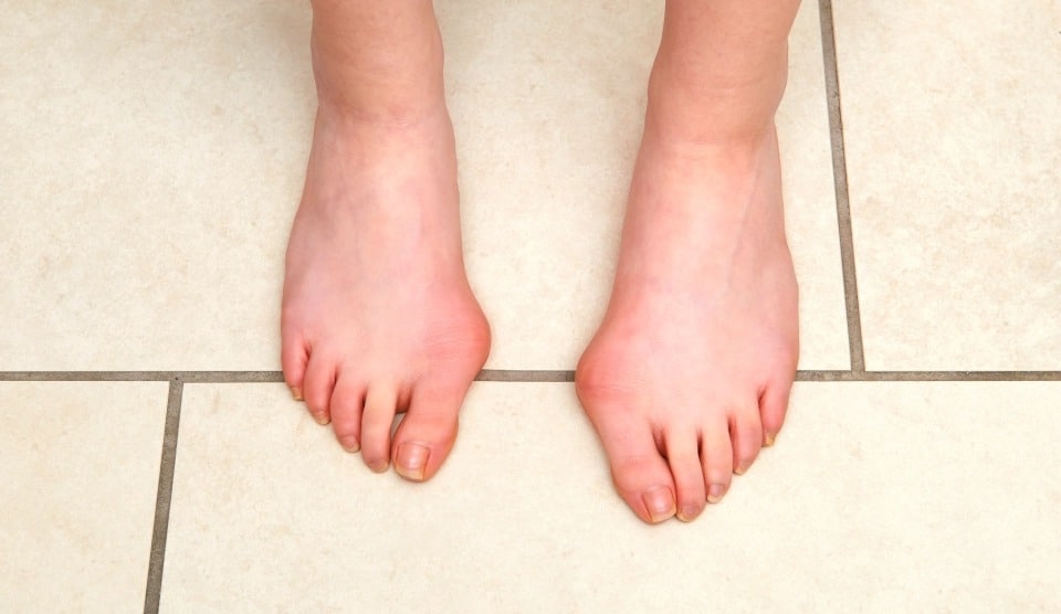 Как ступни отображают состояние здоровья — 8 сигналов о серьезных заболеваниях может, причины, признаком, обуви, крови, могут, свидетельствовать, обувь, можно, выросты, нужно, синдром, к врачу, внимание, которые, чтобы, причина, заболеваниях, которая, босиком