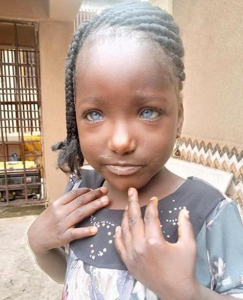 Эта нигерийская девушка с голубыми глазами родилась. 03