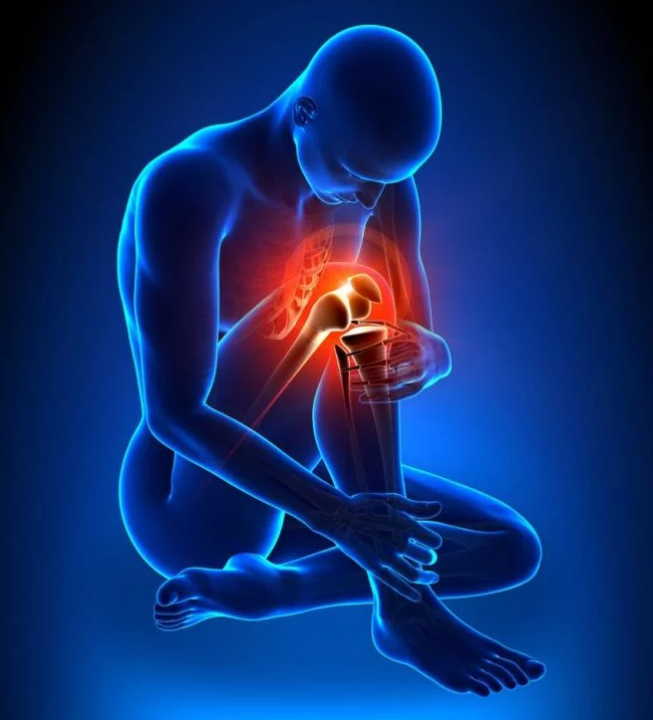 10 мифов о болезнях суставов