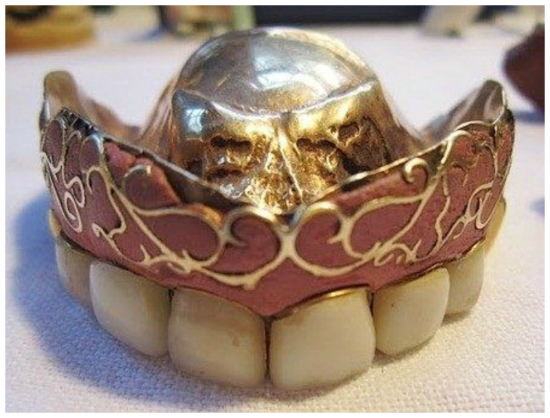 Антикварная вставная челюсть - золото, эмаль интересное, прошлое, стоматологи, ужас, факты