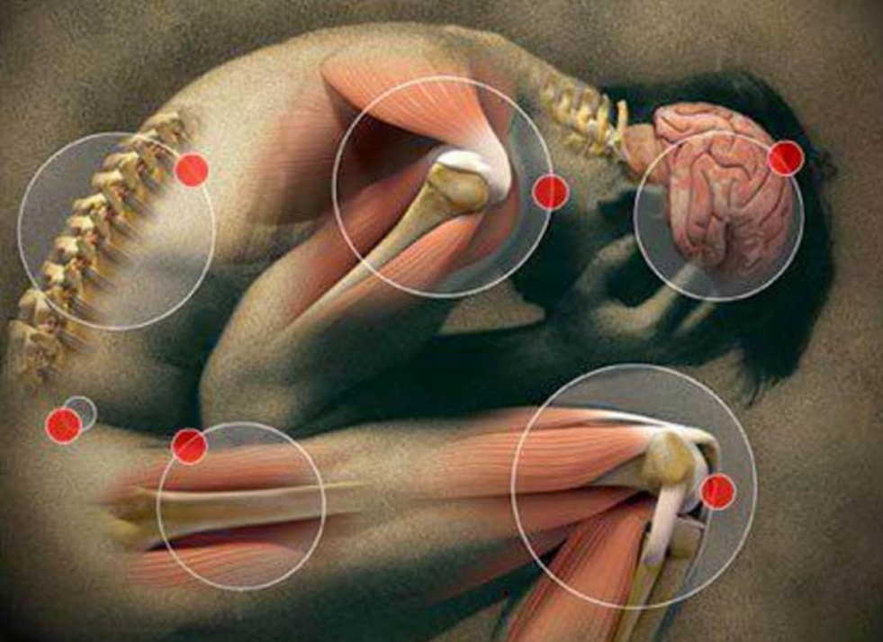 10 мифов о болезнях суставов