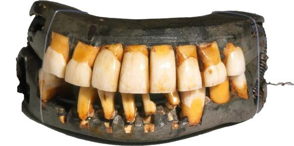 Зубные протезы XIX века Зубы, Зубные протезы, История медицины, 19 век, Длиннопост