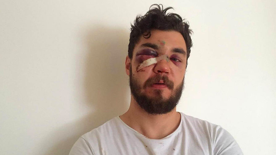 Активист остался без зубов, но с грамотой Активист остался без зубов, но с грамотой автомобили,автомобиль,гибдд,машины,пдд,происшествия,Россия