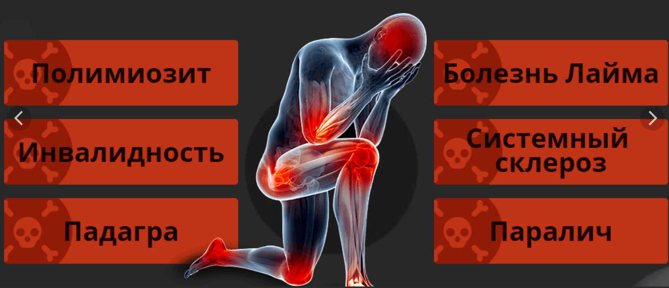 10 мифов о болезнях суставов