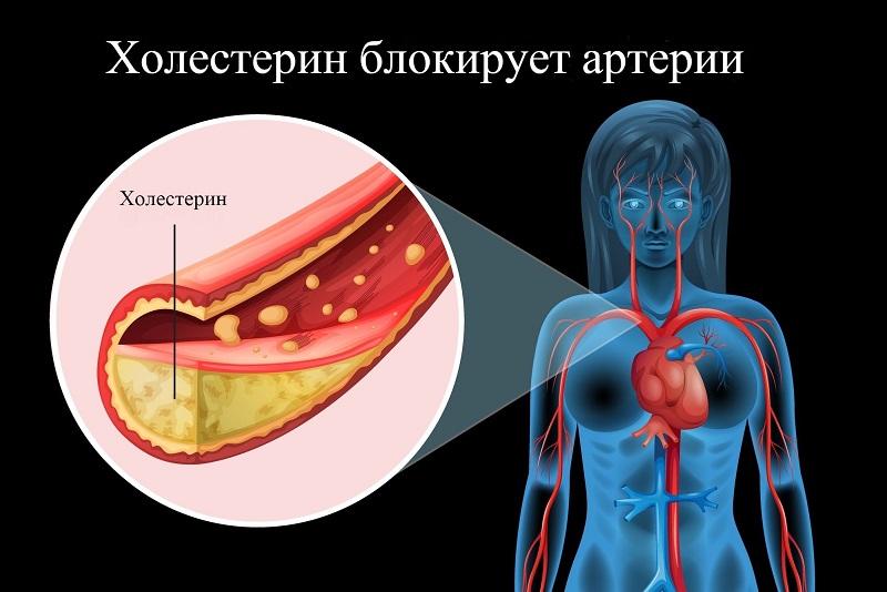 чистка сосудов народными средствами