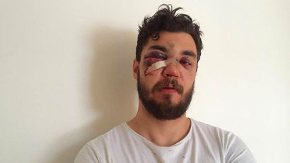 Активист остался без зубов, но с грамотой Активист остался без зубов, но с грамотой автомобили,автомобиль,гибдд,машины,пдд,происшествия,Россия