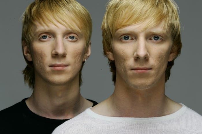 Самые известные близнецы российского шоу-бизнеса близнецы,наши звезды,шоу,шоубиz,шоубиз