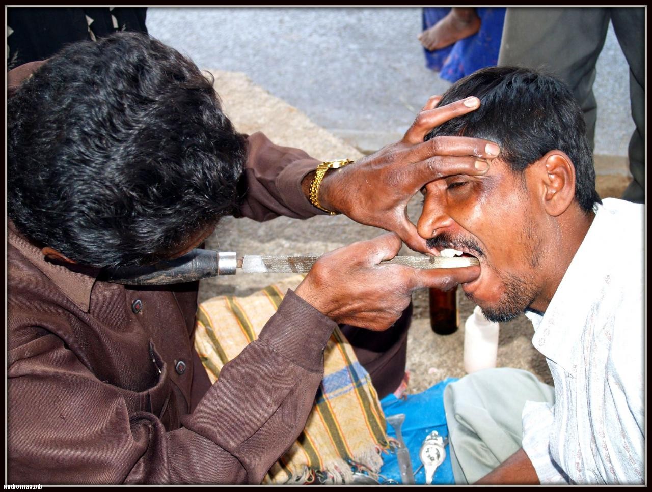 Как работают уличные стоматологи Индии стоматологов, стоматологических, уличные, специалистов, колледжей, Индии, числа, населения, работу, увеличение, словам, настоящее, время, более, штате, пациентам, Керала, стоматолога, лечение, среди