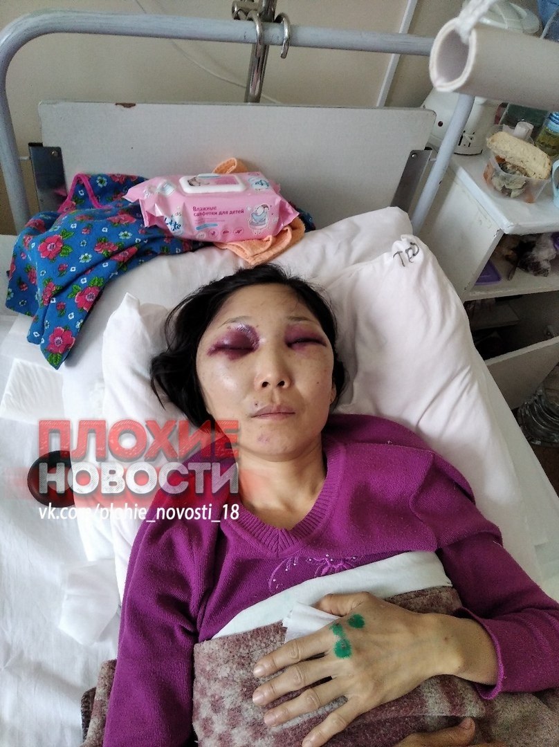 В Калмыкии 20-летний сын сотрудника ГИБДД, находясь за рулем "Лады Гранты", сбил на пешеходном переходе женщину аварии,авто и мото,автоновости,НОВОСТИ,Россия