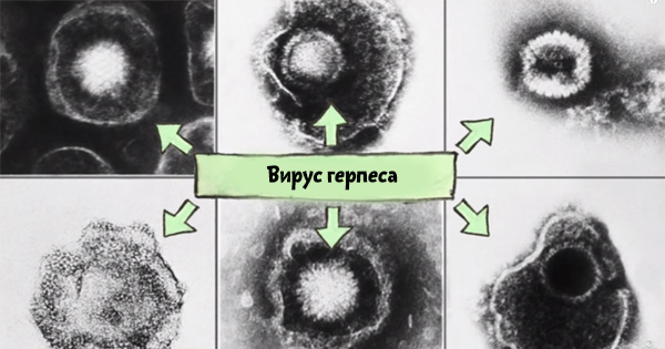 герпес на губах