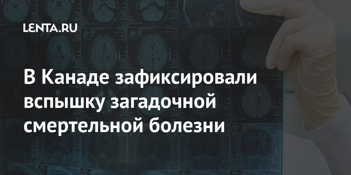 В Канаде зафиксировали вспышку загадочной смертельной болезни случаев, симптомы, связано, время, болезни, галлюцинации, Большинство, случай, подозрительный, только, зарегистрирован, кожеВ, ползают, насекомые, будто, Врачи, ощущение, испытывать, начали, также