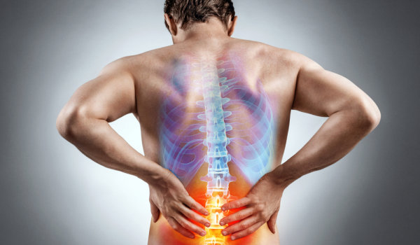 миофасциальная боль