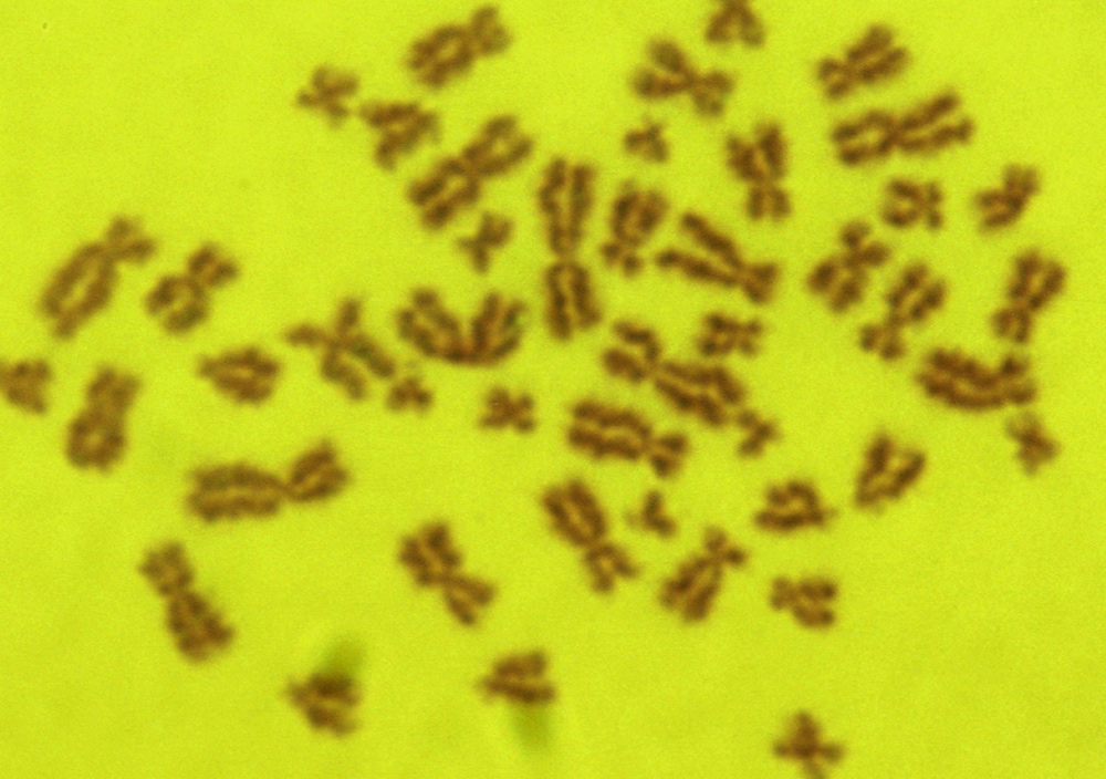 Human_karyotype_(259_32)_Ka.jpg