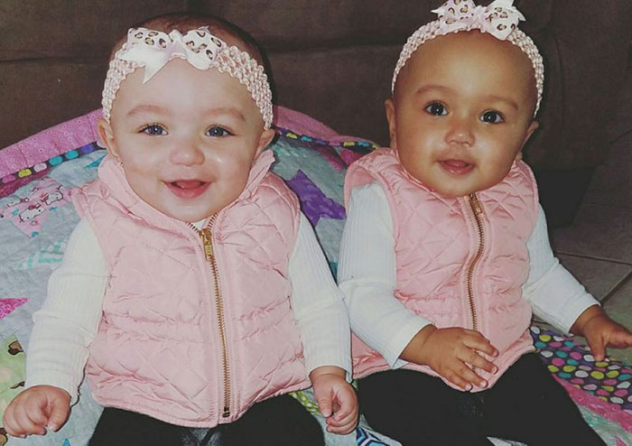 Один белый, другой загорелый: редкий случай рождения близнецов с разным цветом кожи
