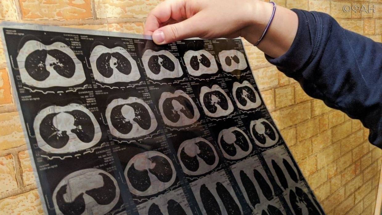 Врач из Дагестана назвала рвоту и увеличившийся живот симптомами детской онкологии