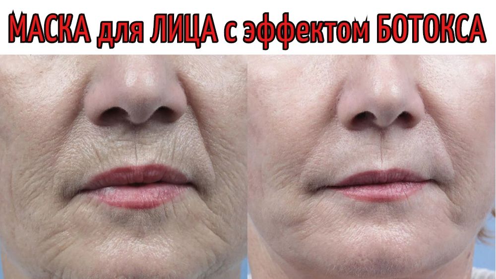 НЕВЕРОЯТНАЯ МАСКА для лица с ЭФФЕКТОМ БОТОКСА