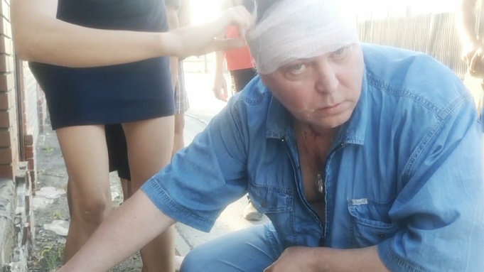 Мигранты разбили голову депутату Госдумы, который призывал 
