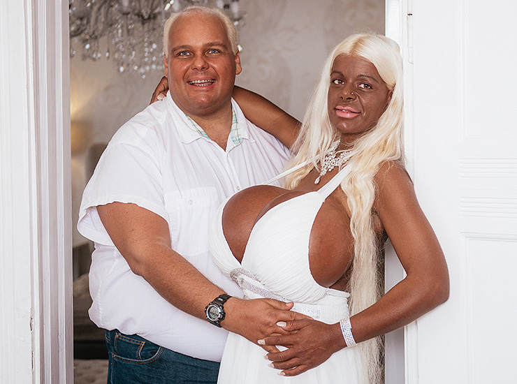 Любовь зла: как выглядят мужья женщин, помешанных на пластике Любовь зла: как выглядят мужья женщин, помешанных на пластике знаменитости,красота,мода и красота,пластические операции