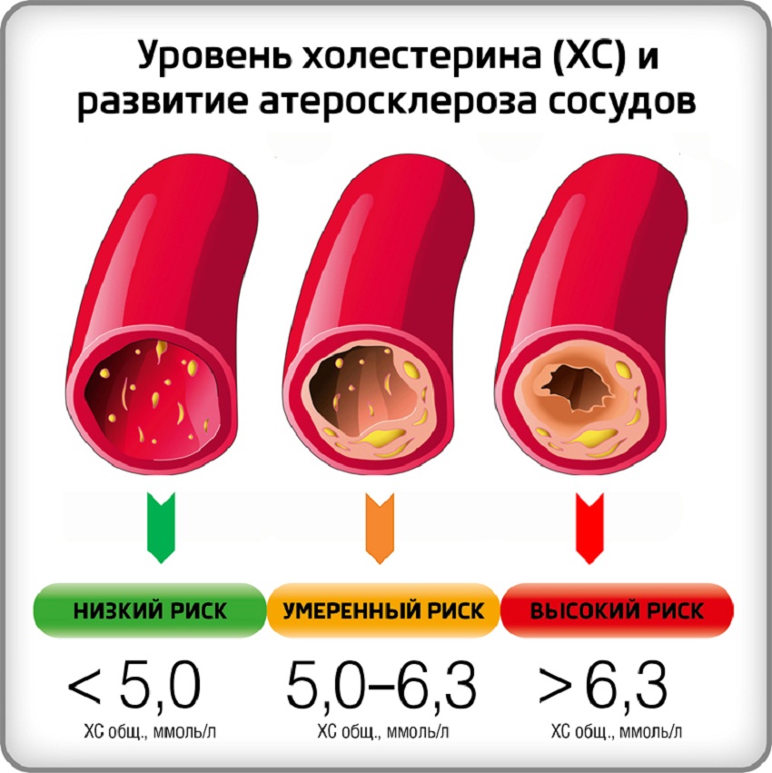 Уровень холестерина в крови