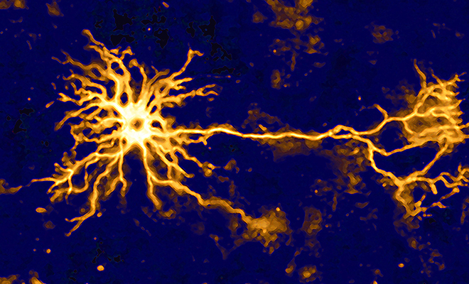 В человеческом мозге зафиксировали импульсы, которых ранее ни разу не замечали. Взаимодействие похоже на компьютер которые, через, всплеск, кальция, Теперь, ученые, более, клеточном, мозге, нейрон, информацию, нейромедиаторов, имеет, именно, кальций, оказалось, Когда, импульс, электрический, управляет