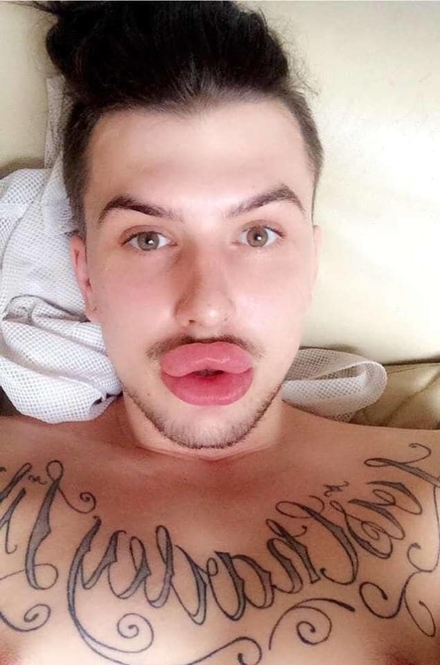 Парни, прекратите накачивать губы внешность