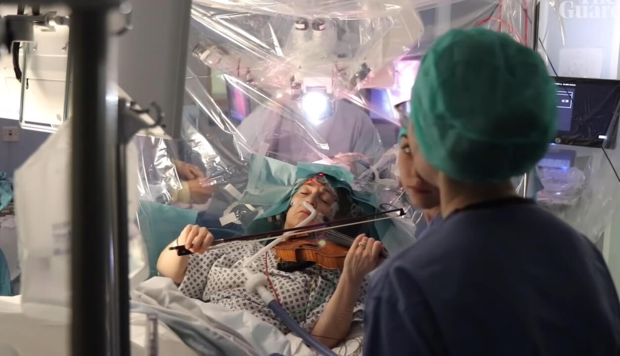 Зачем хирурги попросили женщину играть на скрипке во время операции на мозге?
