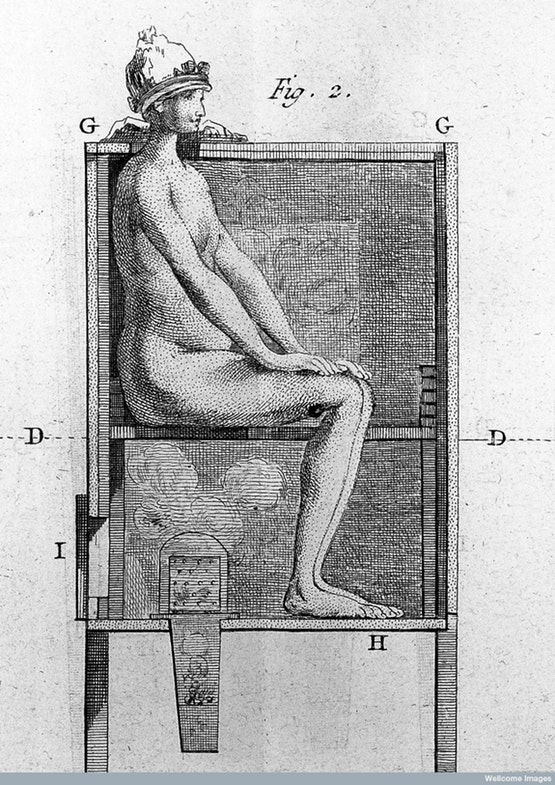 Treatment of syphilis by fumigation, Lalouette, 1776.