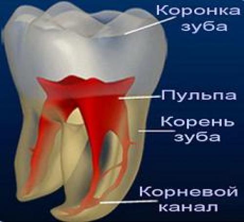 Лечение пульпита. Пульпит: симптомы и лечение, удаление нерва в зубе 01