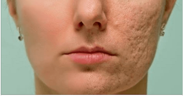 ����� ��������� �����, ���� � ������� �� ����� ����