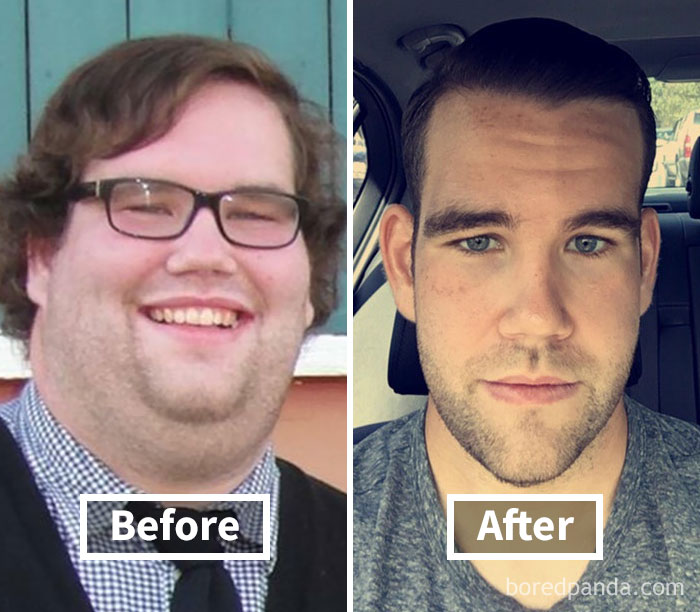 Lost 130 Lbs In 2 Years. Face Gains!