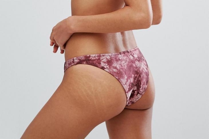 О чём пытается предупредить кожа, проблемы с кожей