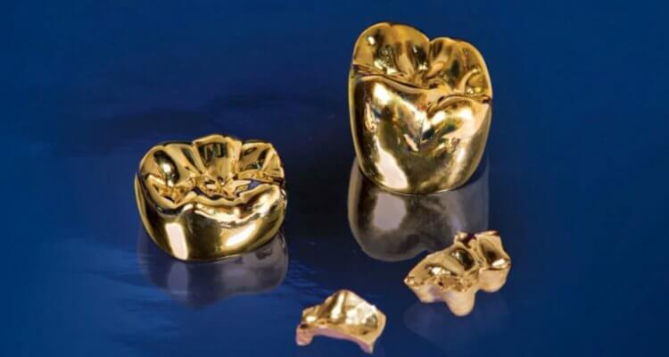 Почему во времена СССР были популярны золотые зубы золотых, зубов, золотые, коронок, могли, очень, можно, коронки, настоящие, материалов, другие, времена, сплавов, золота, который, современном, обладают, других, искусственные, напылением