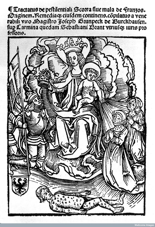 Woodcut: Syphilis: 1496