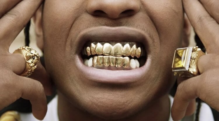 Почему во времена СССР были популярны золотые зубы золотых, зубов, золотые, коронок, могли, очень, можно, коронки, настоящие, материалов, другие, времена, сплавов, золота, который, современном, обладают, других, искусственные, напылением