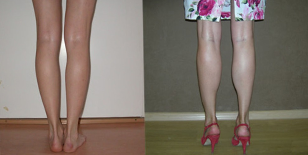 Странные изменения внешности, которые все больше набирают популярность Странные изменения внешности, которые все больше набирают популярность