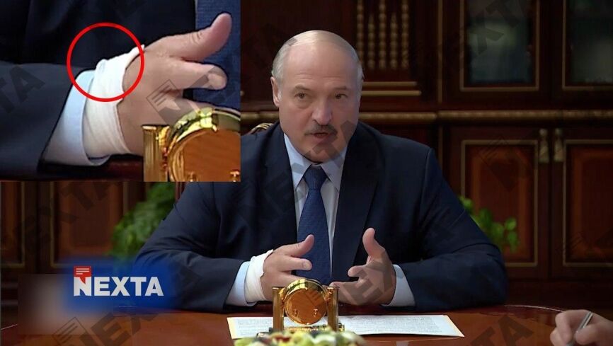 Лукашенко пришел на совещание с катетером