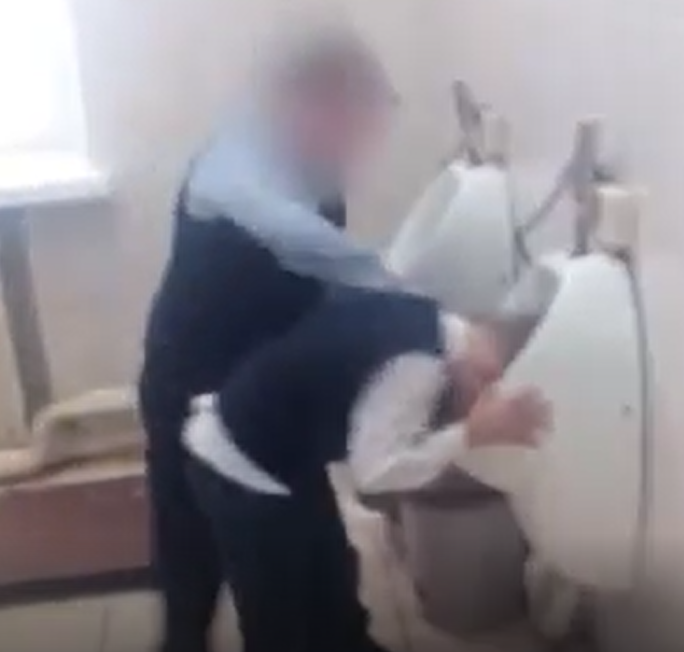 v-unitaz-golovoy-foto