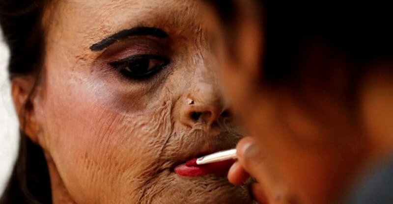 Женщина пострадала от кислотной атаки, а теперь ей наносят макияж перед показом мод к Международному женскому дню в Мумбаи добро, доброта, животные, люди, поступок, спасение, человечность