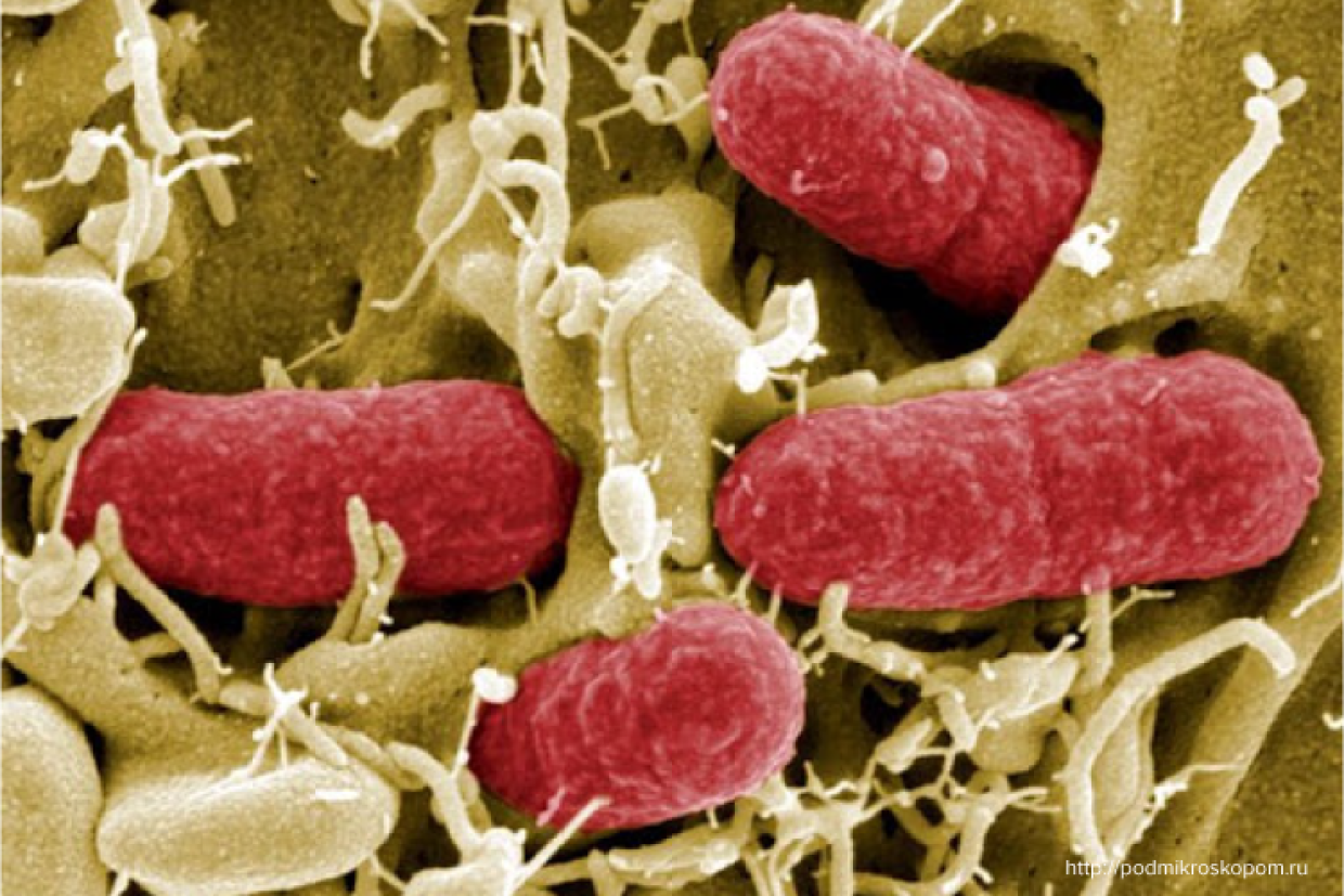 Микроорганизмы кишечная палочка. Бактерия Escherichia coli под микроскопом. Эшерихии под микроскопом. Супербактерия кишечная палочка. Escherichia coli под микроскопом.