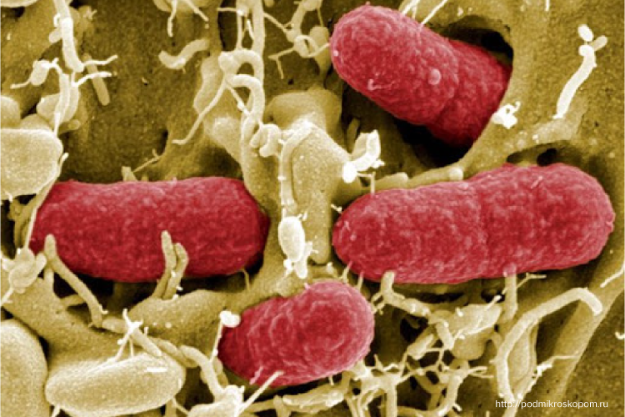 Бактерии палочки. E coli под микроскопом. Кишечная палочка под микроскопом. Кишечная палочка микроб. Кишечная палочка в микроскопе.