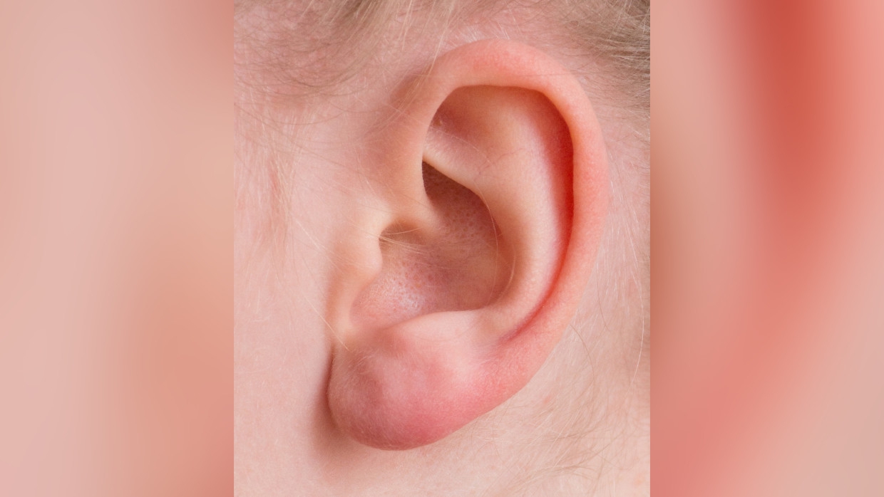 Потерю слуха назвали характерным признаком индийского штамма коронавируса
