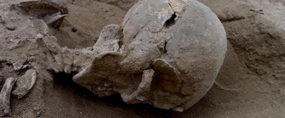 ​Пробитый череп одной из жертв reuters.com - Топ-10 новостей 2016 года | Военно-исторический портал Warspot.ru