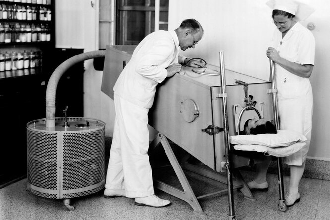 История ИВЛ: как спасали людей от библейских времён до наших дней История ИВЛ: как спасали людей от библейских времён до наших дней здоровье,интересные факты,история,медицина