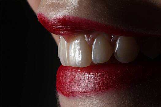 Советы врача: Как предотвратить образование пятен и оскомин на зубах