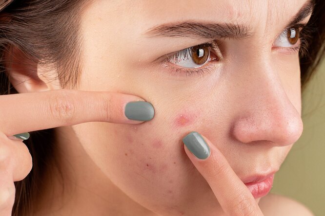5 заболеваний, о которых может сигнализировать наша кожа
