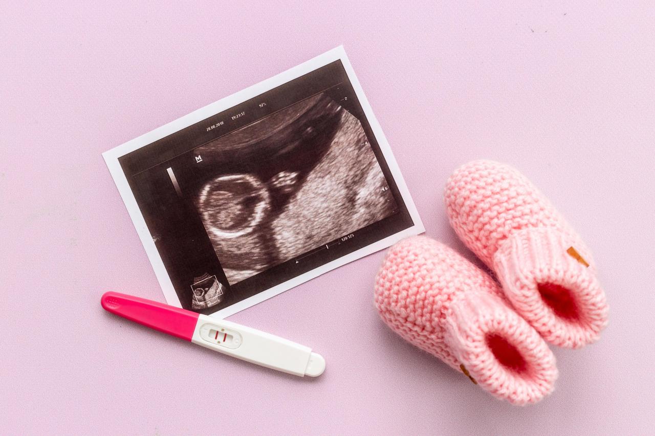 Впервые в России: в Петербурге женщина родила четверых близнецов более, беременность —, случаев, очень, беременности, развитие, эмбрионов, четверни —, всегда, общей, случай, плаценты, похожи, такие, недели, однояйцевой, родильного, сестры, девочкиТакже, двойняшки