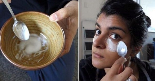 This girl put baking soda under her eyes. Just look what happened as a result! 