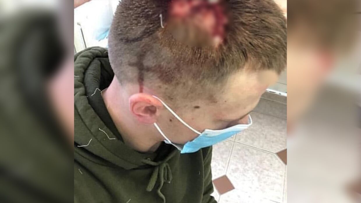 В Крыму рассказали правду о «пострадавшем» парне от полицейских на ЮБК