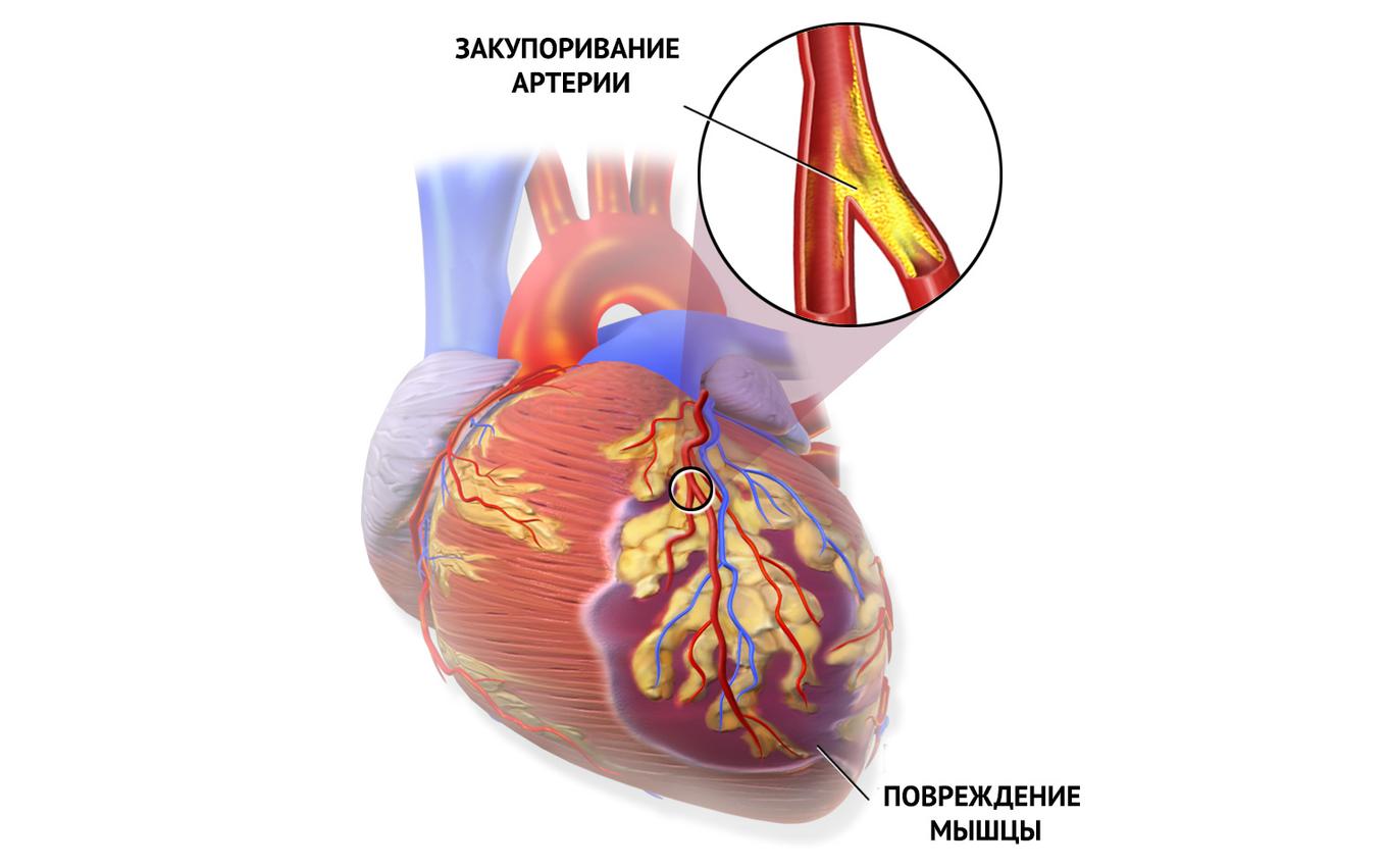 Чем нас лечат: Конкор. Принимать ли близко к сердцу? здоровье,лекарства,медицина